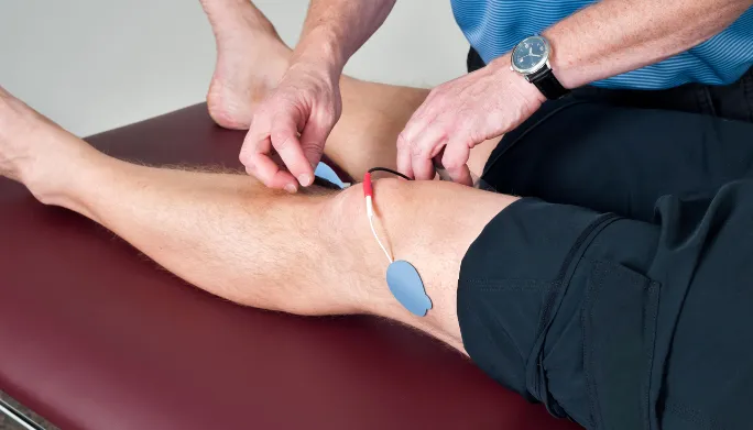 Patient testimonials on Arlington Physical Therapy's site featuring effective dry needling and cupping treatments.